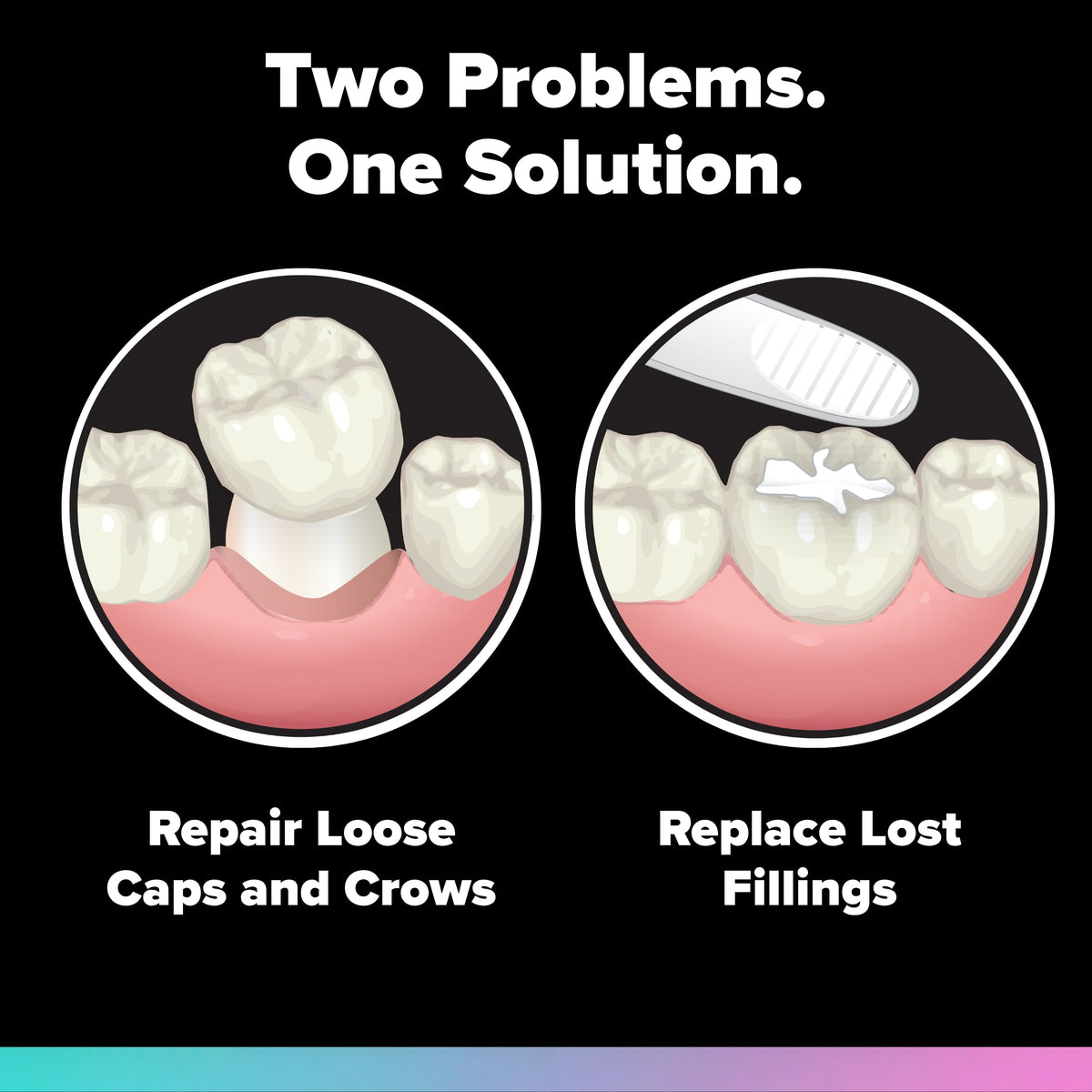 Loose Cap and Lost Filling Repair Dental Kit B79312