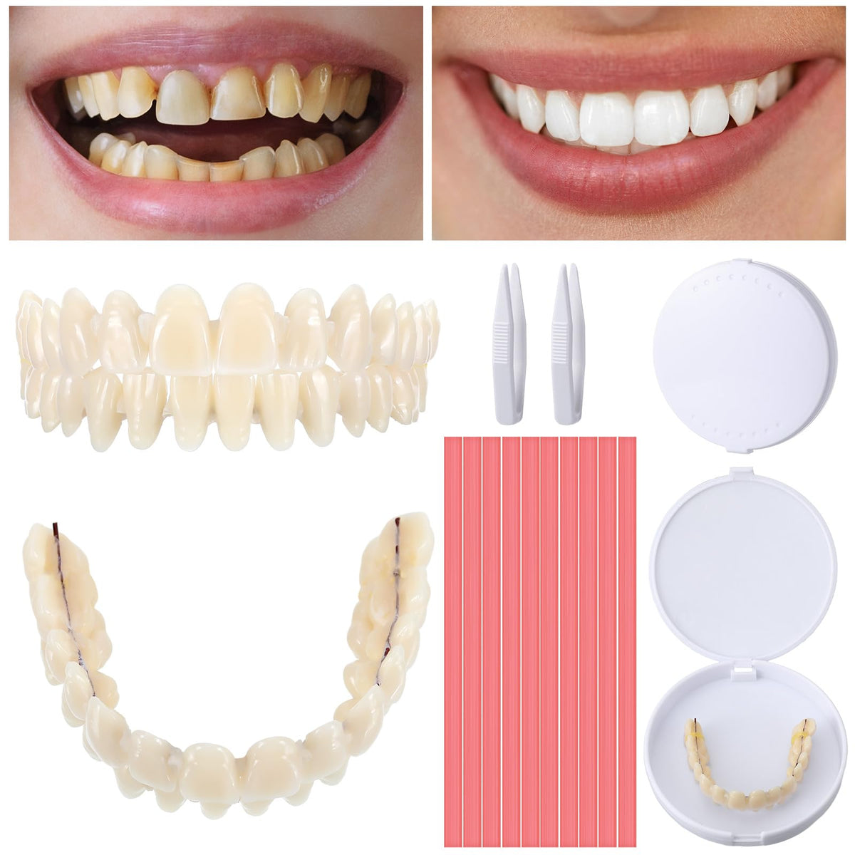 16 Pcs Dentures DIY Repair Kit R903008